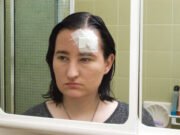 How Long Does an Attorney Need to File a Personal Injury Claim for an Accident in Florida? Motorcycle-Head-Brain-Injuries