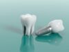 Dental Implants 101: Everything You Need to Know implants