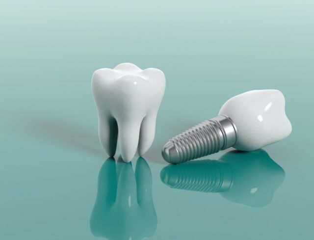 implants