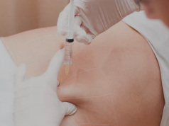 Fat Dissolving Injection: A Complete Guide to Non-Surgical Body Contouring fat dissolving injection