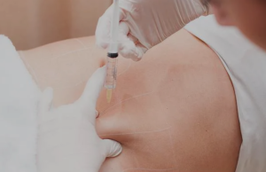 Fat Dissolving Injection: A Complete Guide to Non-Surgical Body Contouring fat dissolving injection